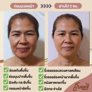 รีวิวนวดหน้า ครูธัญญ์