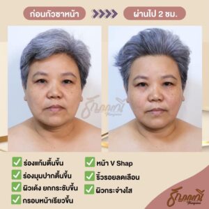 รีวิวนวดหน้า ครูธัญญ์