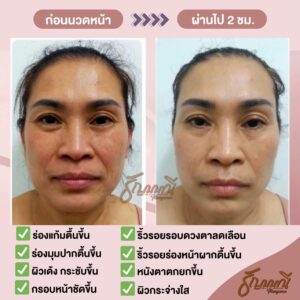 รีวิวนวดหน้า ครูธัญญ์