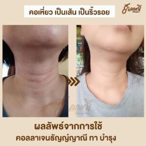 รีวิวนวดหน้า ครูธัญญ์